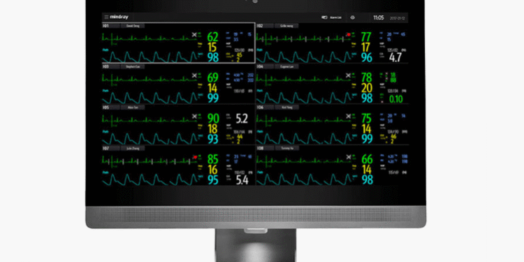 CMS_Mindray_BenevisionViewer